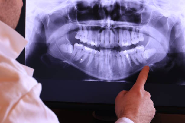 Best Broken or Cracked Tooth Emergency Dentist in Dunlap, IN